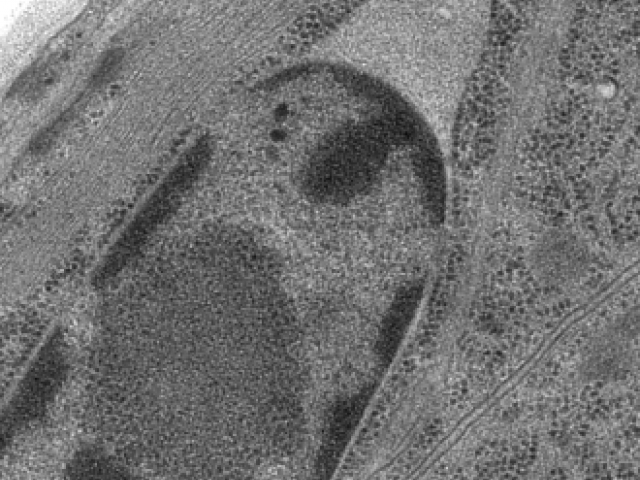 Electron microscope image of C. elegans