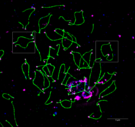 Meiotic chromosomes